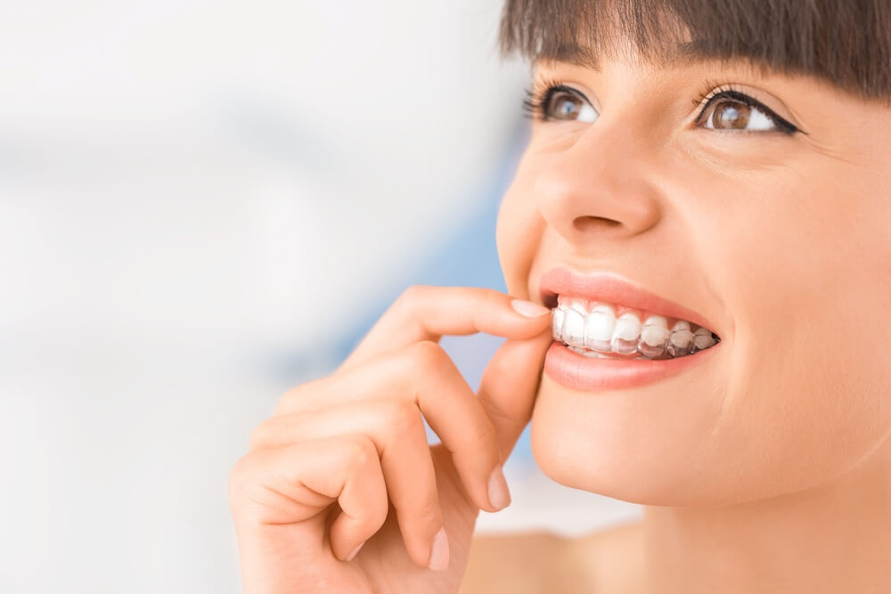 How to Speak Clearly with Invisalign: Common Word Challenges