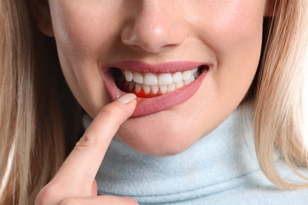 Invisalign for Periodontal Patients: Special Considerations When You Have Gum Disease