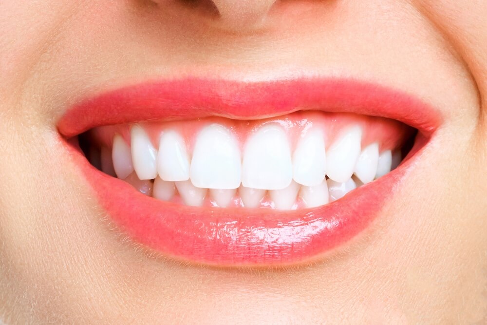 Bright White Smile