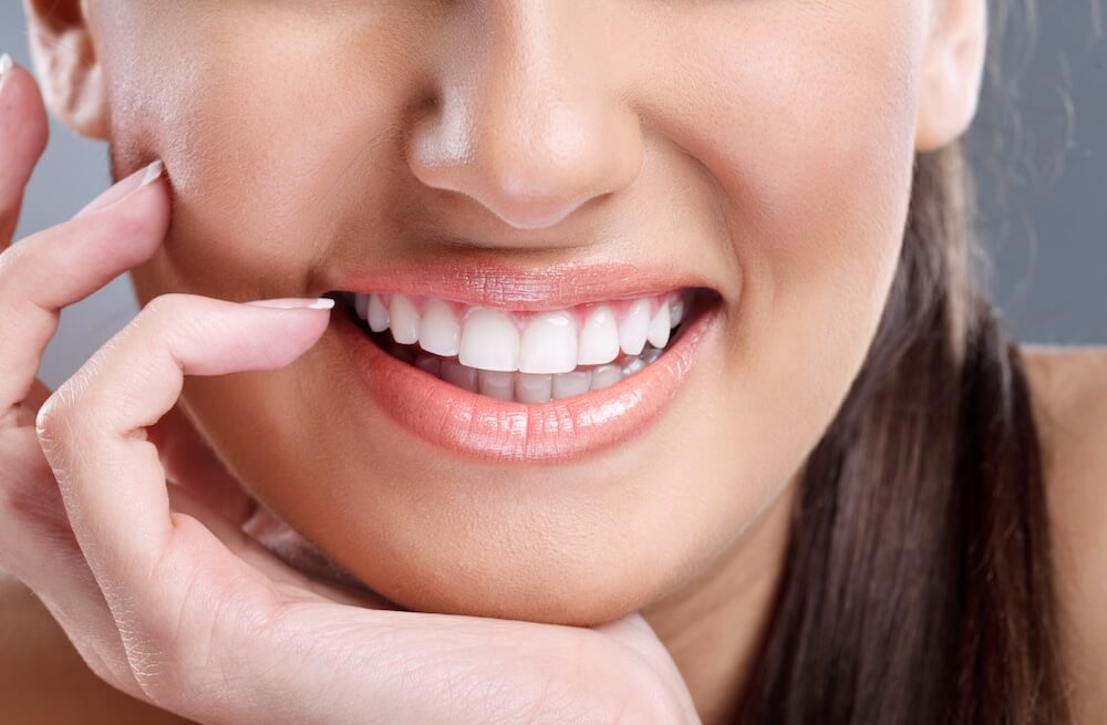 Can You Get Cavities With Veneers?